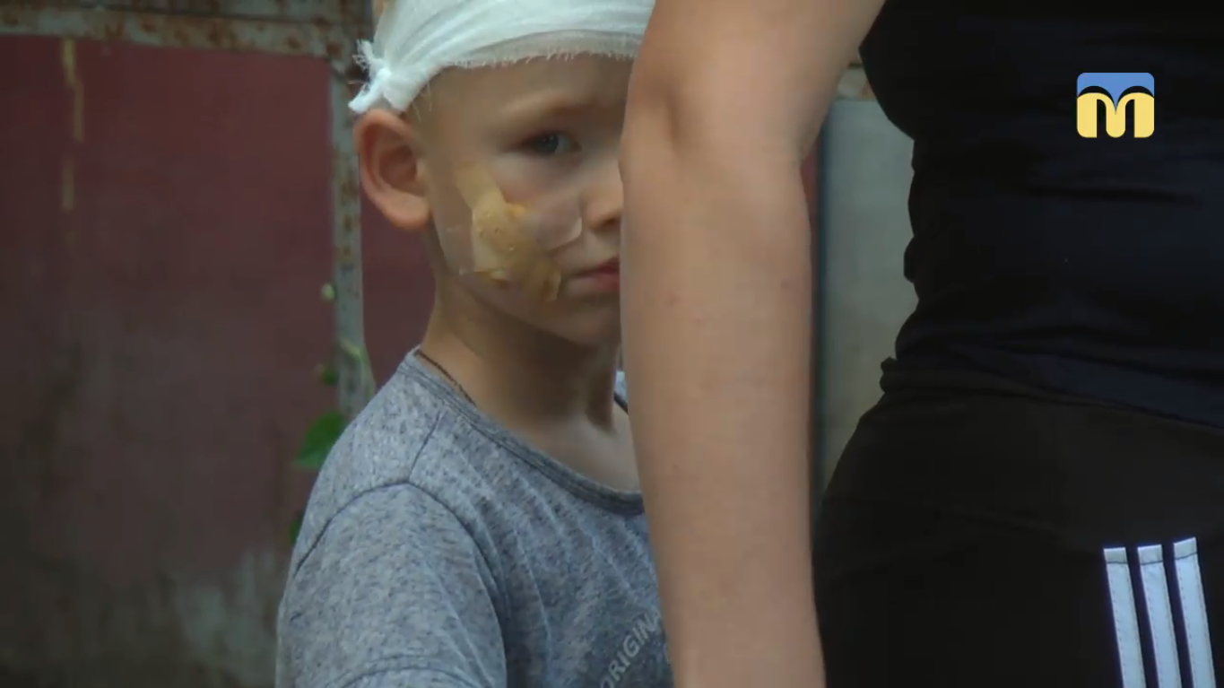 Собаку, напавшую на 4-летнего мальчика в Николаеве, поместили под наблюдение. Ребенок чувствует себя хорошо