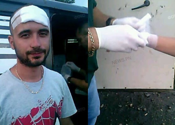 В Николаеве отстранили от работы водителя коблевской маршрутки, в которой рассыпавшийся люк ранил двух пассажиров