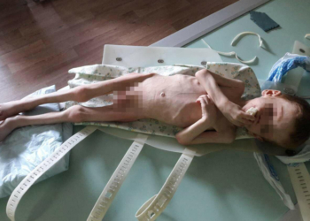 СМИ: В Новоукраинке родители морили голодом 4-летнего сына