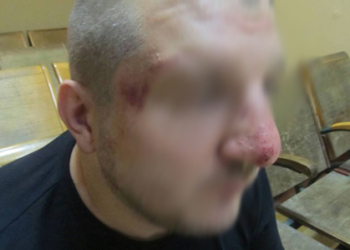 Российские пограничники избили украинца