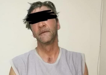 В Одессе взяли под домашний арест мужчину, облившего кислотой ребенка