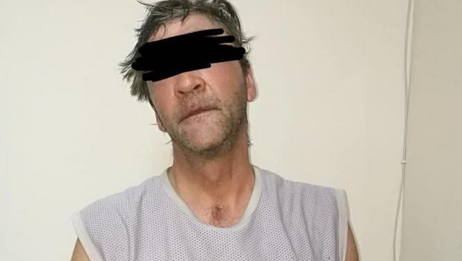 В Одессе взяли под домашний арест мужчину, облившего кислотой ребенка