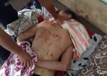 Наркоман разбушевался. В Николаеве мужчина нанес себе телесные повреждения и разгромил квартиру (18+)