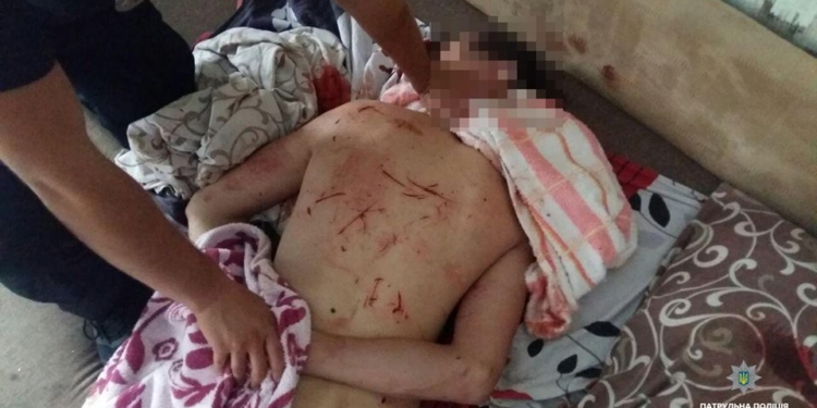 Наркоман разбушевался. В Николаеве мужчина нанес себе телесные повреждения и разгромил квартиру (18+)