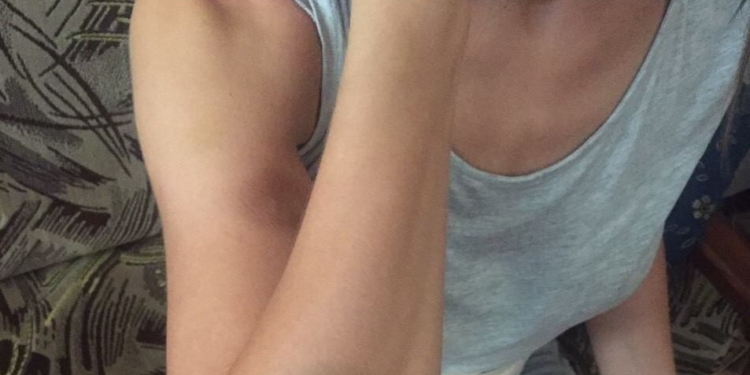 В Николаеве ревнивец взял в плен свою девушку. Освобождали спасатели и полиция, девушка в больнице