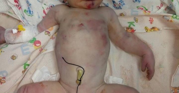 Жуть. Ребенок, подброшенный в «Окошко жизни» на Николаевщине, был с многочисленными синяками и черепно-мозговой травмой