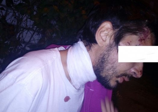 В «Северном» подростки с ножами напали на уличного сборщика металлолома