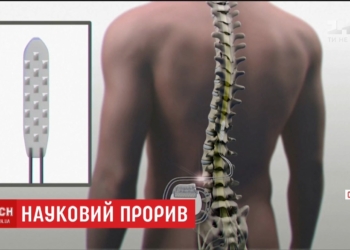 Научный прорыв: успешно испытан имплантат, позволяющий ходить парализованным людям