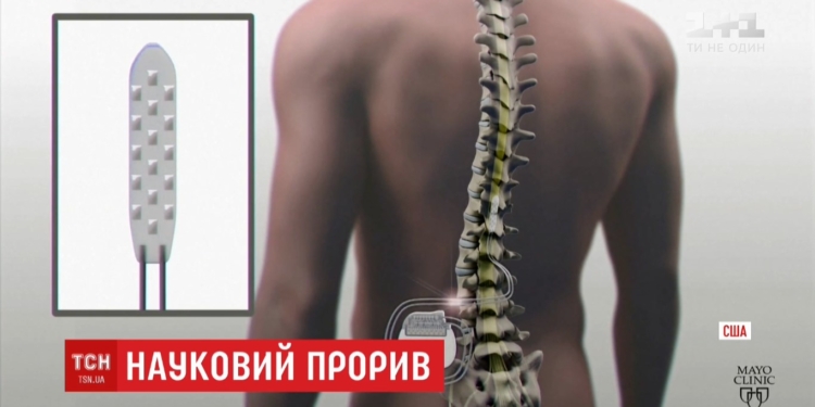 Научный прорыв: успешно испытан имплантат, позволяющий ходить парализованным людям