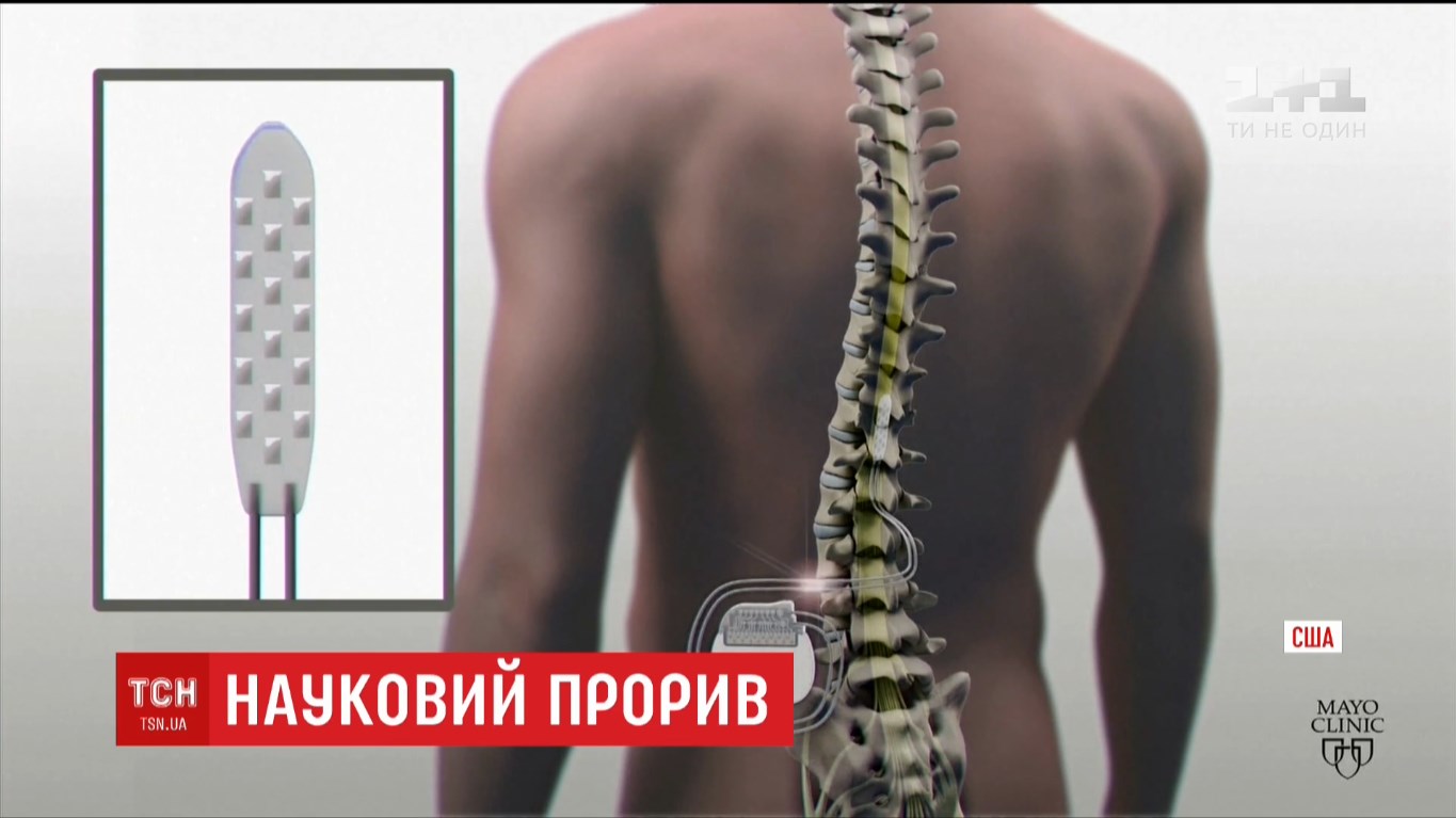 Научный прорыв: успешно испытан имплантат, позволяющий ходить парализованным людям