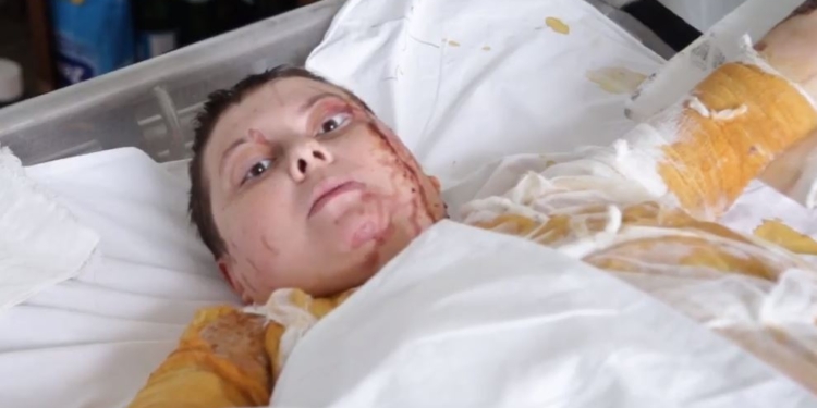 Видеообращение облитой кислотой Катерины Гандзюк: Я выгляжу плохо, но правосудие и справедливость в Украине выглядят еще хуже