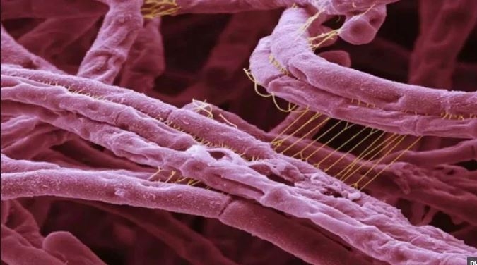 Не расслабляйтесь: в Украине официально насчитывают более 3,5 тысяч очагов сибирской язвы