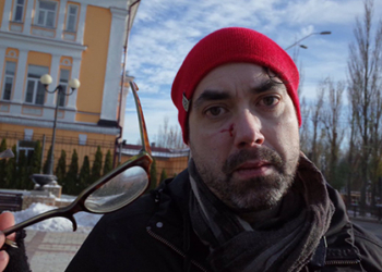 Из-за нападения на канадского фотографа в Киеве открыто производство