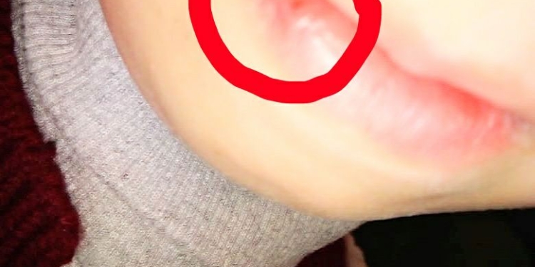 В Николаеве водитель маршрутки устроил драку с пассажиром из-за места в автобусе. Также пострадала школьница