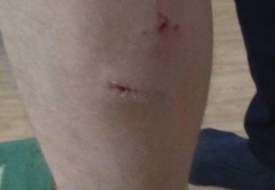 Жительница Николаева сказала, что собака укусила ее ребенка возле школы