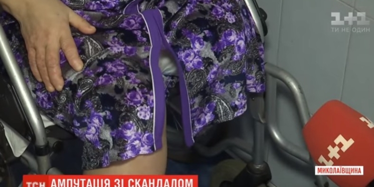 Ошибка или халатность? На Николаевщине женщине ампутировали вывихнутую ногу