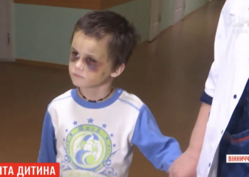 Следы изуверских побоев 6-летнего мальчика мачехой заметили только пассажиры электрички