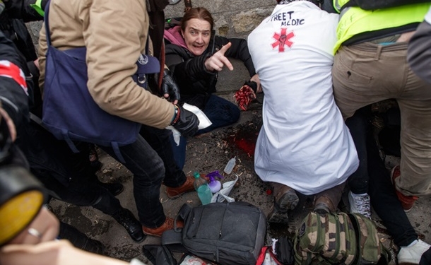 В Париже одному из протестующих оторвало руку