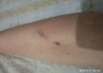 Жительница Николаева заявила, что ее избили и обокрали кондукторы и водитель троллейбуса