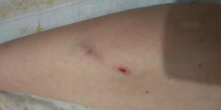 Жительница Николаева заявила, что ее избили и обокрали кондукторы и водитель троллейбуса