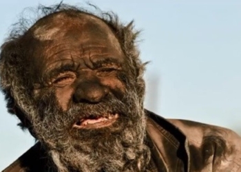 Само не отваливается. Как выглядит человек, который не мылся 60 лет