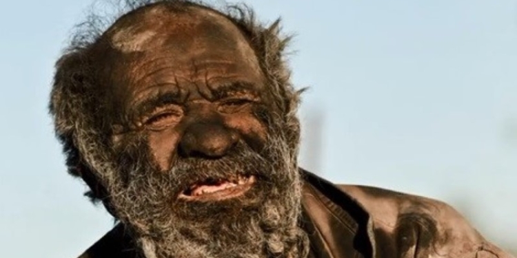 Само не отваливается. Как выглядит человек, который не мылся 60 лет