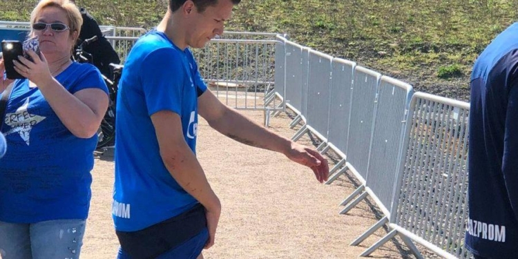 Коноплянка получил травму на тренировке Шальке