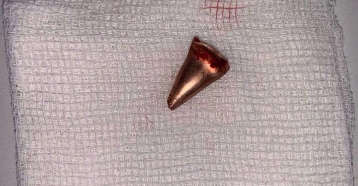 24-летний боец из Николаева получил тяжелое ранение на Донбассе (ФОТО)