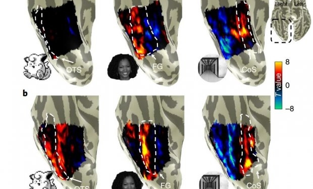 В мозге человека есть “зона покемонов”: ученые