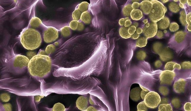 Ученые обнаружили грибы, которые выделяют золото