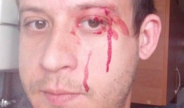 В Николаеве мужчина напал на соседа из-за платежки от управляющей компании (ФОТО)