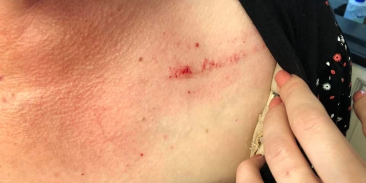 Контролеры в троллейбусе расцарапали жительницу Николаева за то, что она замешкалась с покупкой билета