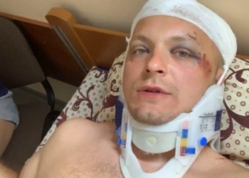 Бывший мэр Конотопа рассказал о своем состоянии после нападения  (ВИДЕО)