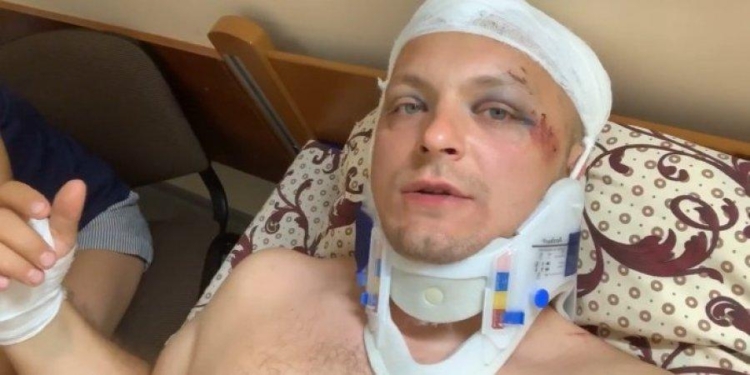 Бывший мэр Конотопа рассказал о своем состоянии после нападения  (ВИДЕО)