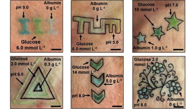 Немецкие ученые предложили измерять уровень глюкозы с помощью татуировки (ФОТО) 2