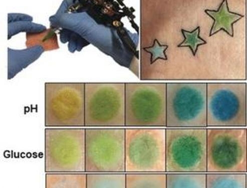 Немецкие ученые предложили измерять уровень глюкозы с помощью татуировки (ФОТО)