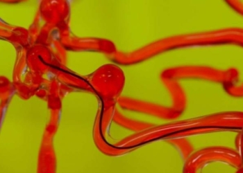 Создан робот-червяк, который будет спасать от инсульта (ВИДЕО)