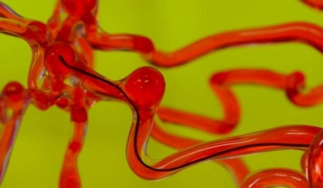 Создан робот-червяк, который будет спасать от инсульта (ВИДЕО)