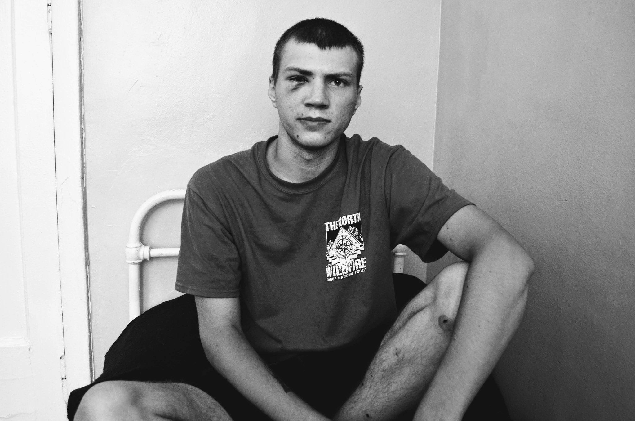 «В моем глазу сейчас насчитывается 750 чужеродных единиц»: николаевцы могут помочь молодому морпеху из 36 бригады