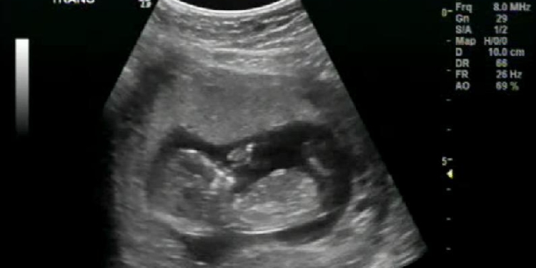 Выбирать пол будущего ребенка скоро можно будет без участия врачей. Ученые считают, что это плохая идея