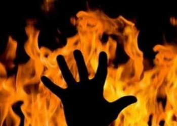 В Днепре дети облили бензином и подожгли 8-летнего мальчика