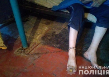 Жительница Днепропетровской области держала взрослого сына на цепи