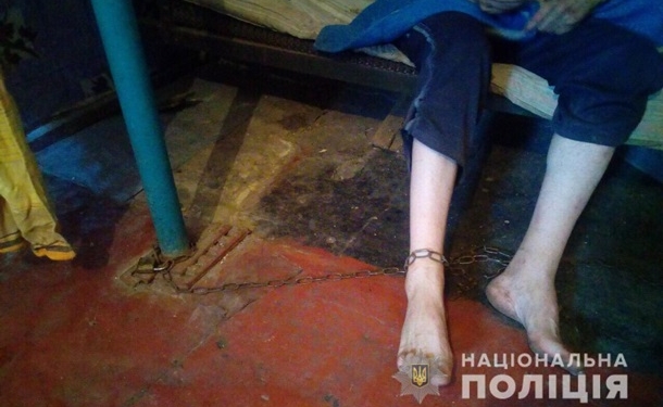 Жительница Днепропетровской области держала взрослого сына на цепи
