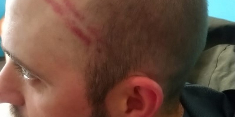 ОБНОВЛЕНО. В Николаеве известный активист заявляет об избиении полицией. У полиции – своя версия произошедшего (ФОТО, ВИДЕО)