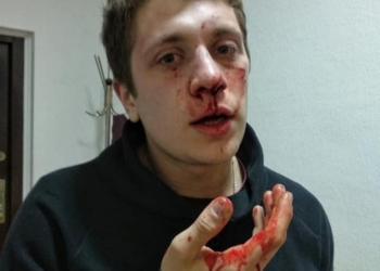 Пятеро в балаклавах избили двух активистов в Днепре