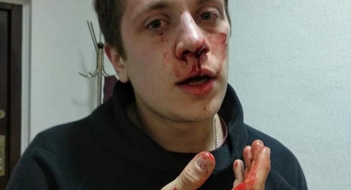 Пятеро в балаклавах избили двух активистов в Днепре