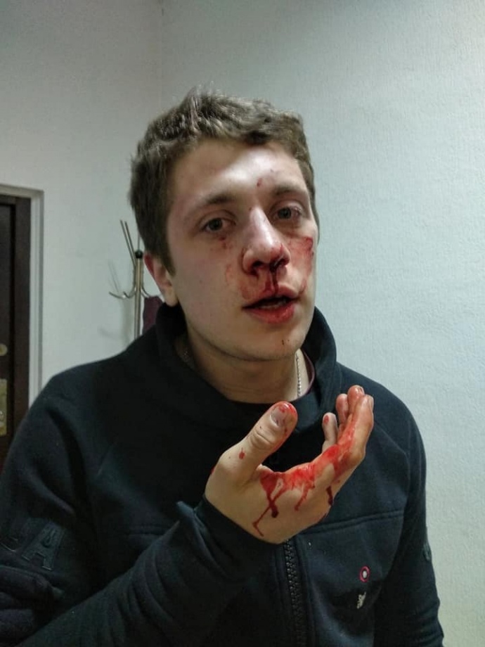 Пятеро в балаклавах избили двух активистов в Днепре 1