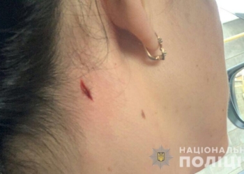 В Николаеве полиция открыла уголовное производство по факту пулевого ранения женщины неподалеку от полицейского стрельбища (ФОТО)