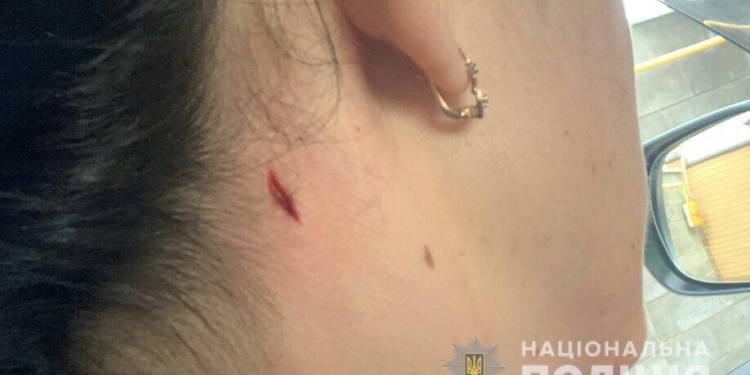 В Николаеве полиция открыла уголовное производство по факту пулевого ранения женщины неподалеку от полицейского стрельбища (ФОТО)