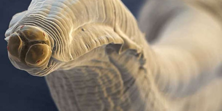 Брр! В каждом пятом жителе Земли живут черви-паразиты – ученые